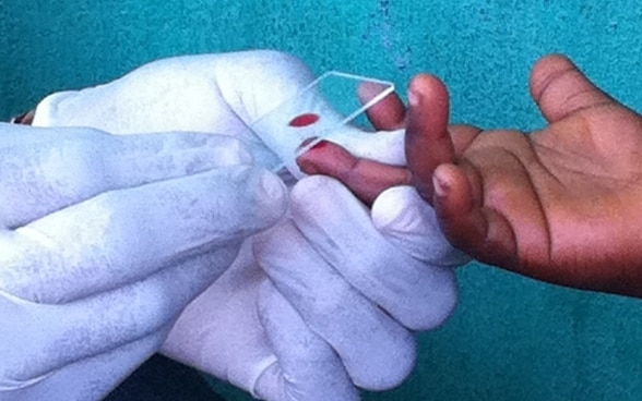 Two hands in white rubber gloves take a blood sample from a child’s hand. 