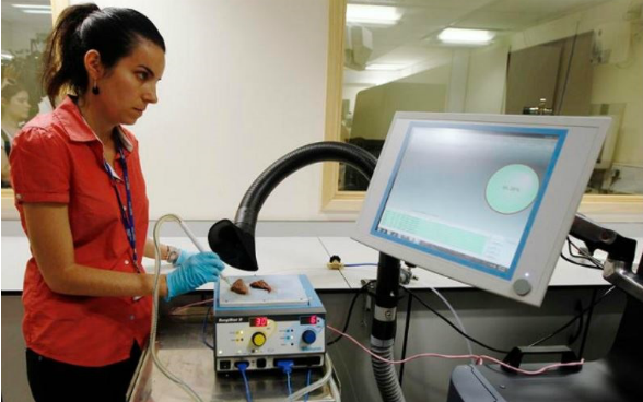 A woman analysing tissues with an 'intelligent' knife connected to a computer